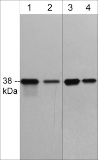 Western blot analysis of human A431 cells (lanes 1 & 2) and rat A7r5 cells (lanes 3 & 4). The blot was probed with mouse monoclonal anti-p38α (C-terminal) clone M548 at a dilution of 1:250 (lanes 1 & 3) or 1:1000 (lanes 2 & 4).