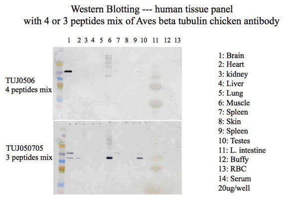 β-Tubulin 3 Immunoblot using homogenates of various organs. Performed at Kingfisher Labs.