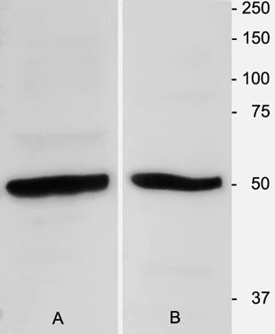 β-Tubulin 3 Immunoblot using homogenates of adult mouse brain (1:3000). Hoda Ilias, Aves Labs.