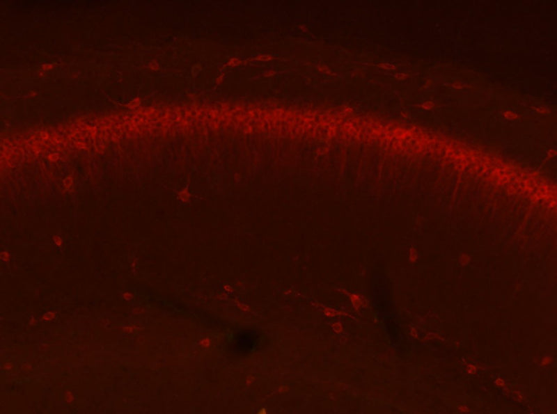 Adult WT and KO mouse hippocampus immunofluorescence with N206A/8 (green) and KC rabbit anti- Kv2.1 (red). Brain samples courtesy of Albee Messing, University of Wisconsin at Madison.